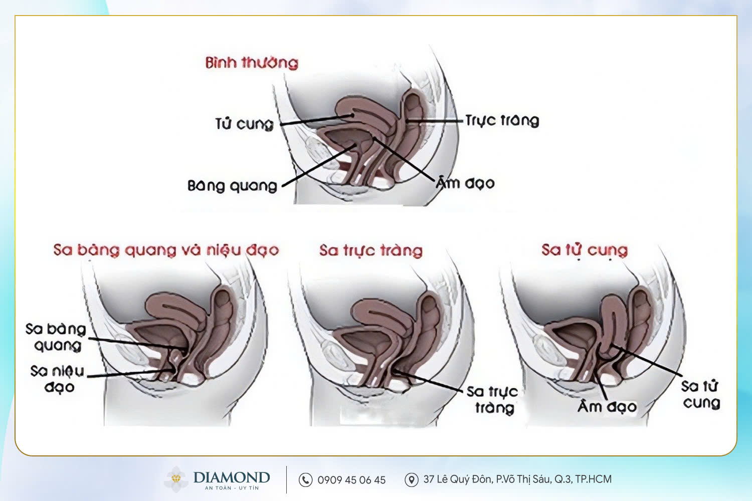 Tổn thương chức năng ruột và bàng quang