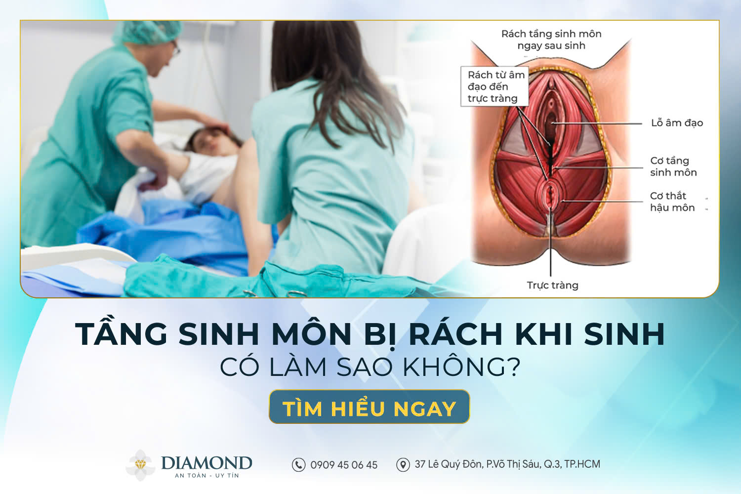 Tầng sinh môn bị rách khi sinh có làm sao không?