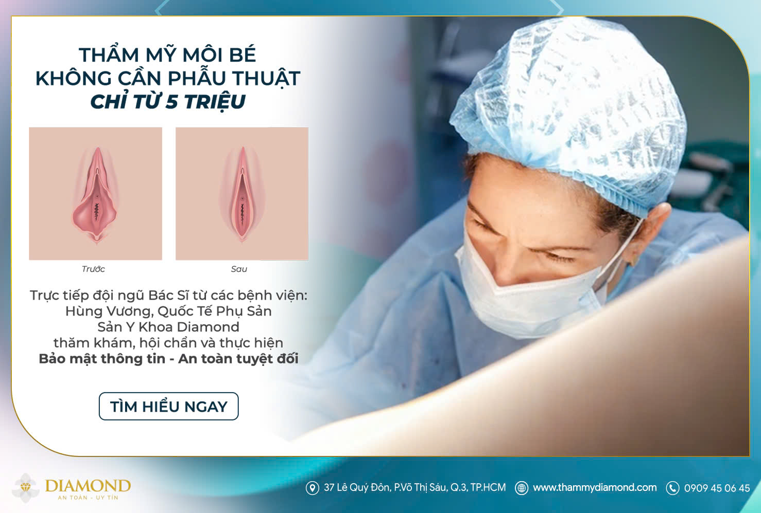 Thẩm mỹ mô bé không cần phẫu thuật chỉ từ 5 triệu