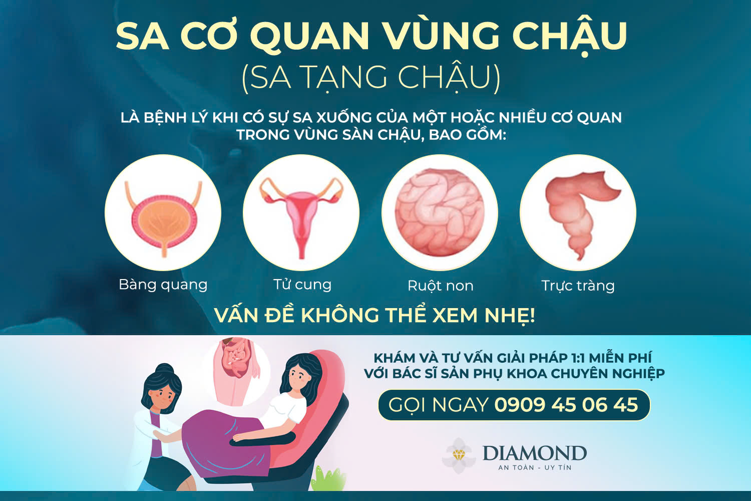 Sa cơ quan vùng chậu (Sa tạng chậu)