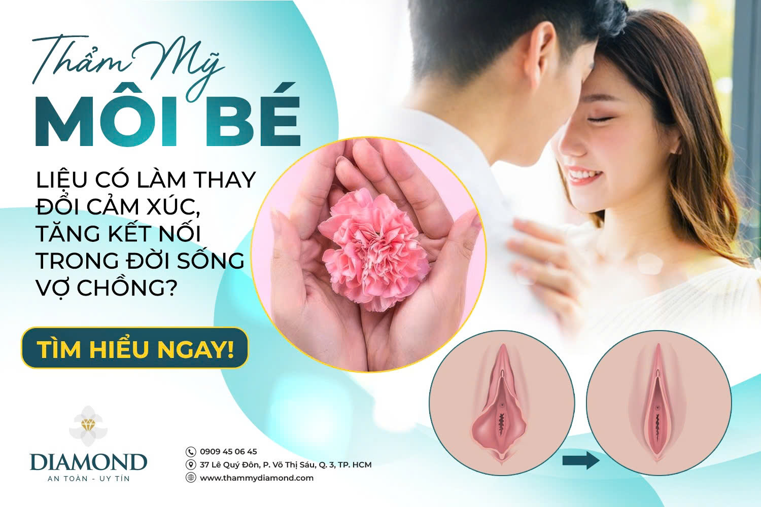 Thẩm mỹ môi bé liệu có làm thay đổi cảm xúc trong đời sống vợ chồng