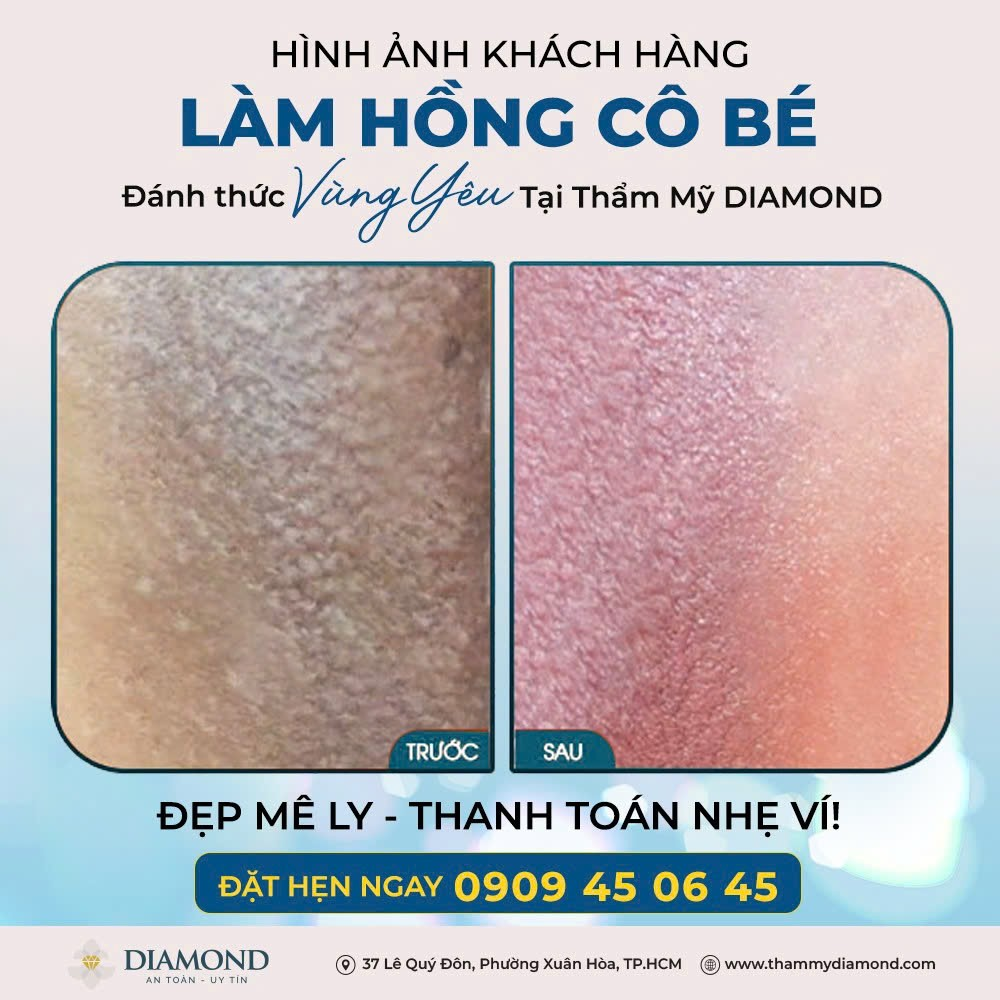 Hình ảnh khách hàng làm hồng cô bé
